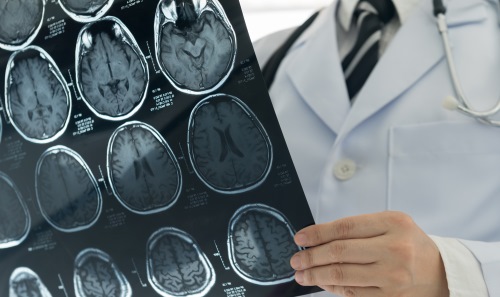 Scientist holding a CT scan 